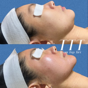 30만원 상당 모공맞춤케어 이용권