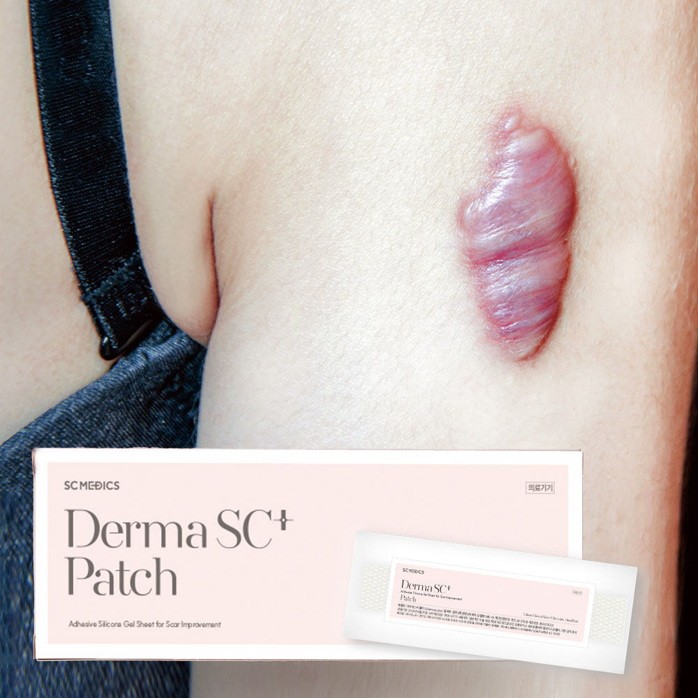 흉터관리 패치 1SET